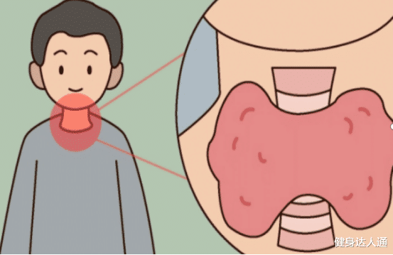 饮食|甲状腺的“祸首”是海鱼?提醒:少吃“1黄2绿”,或能稳甲散结