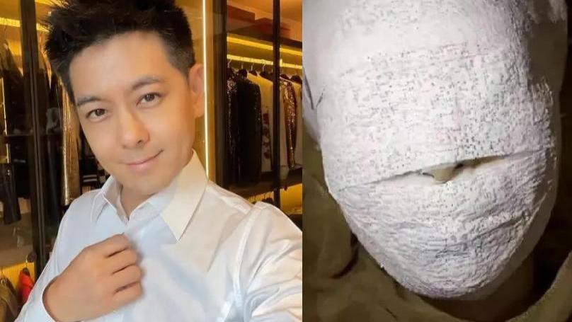 林志颖|林志颖车祸后首露面，脸部清瘦年轻10岁，点蜡烛的手部动作引争议