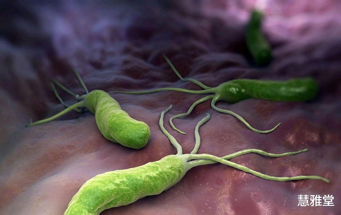 养生|想要改善体内幽门螺旋杆菌,建议从饮食入手,巧用“三物”有帮助