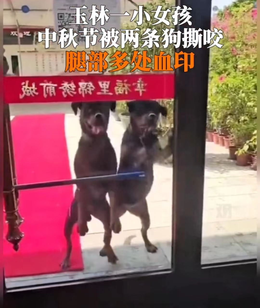 太震惊了 ！两只恶犬撕咬女孩……