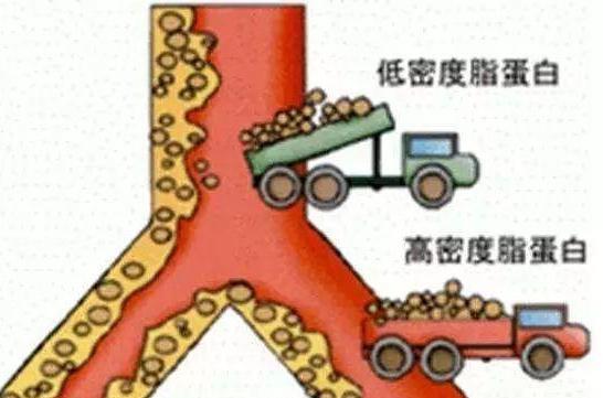 高血压|橘子是高血脂“催化剂”？心内科医生：不想血管堵塞，3果别贪吃