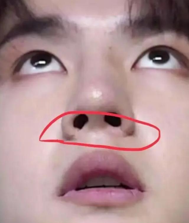 张雨绮|隆过鼻子的十位明星,张雨绮鼻梁变宽,毛晓彤很自然