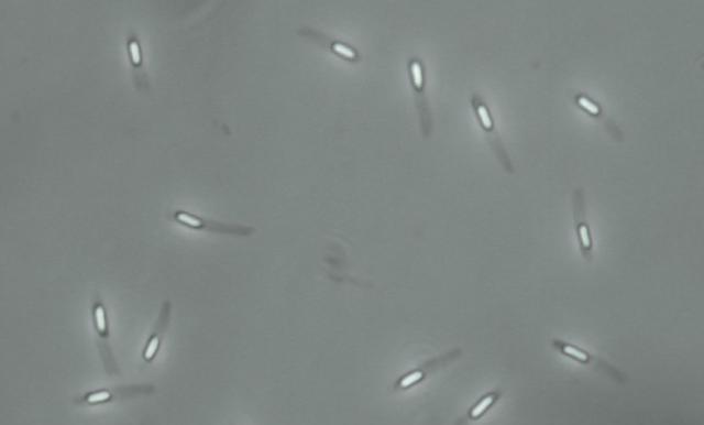 为了永生,科学家给自己注射350万年前的细菌,现在如何了?