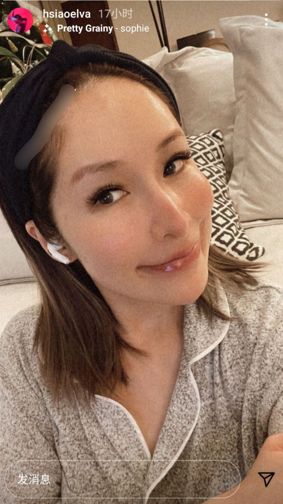 萧亚轩|真毁容了?42岁萧亚轩罕见晒怼脸自拍,疤痕明显超大超深一条