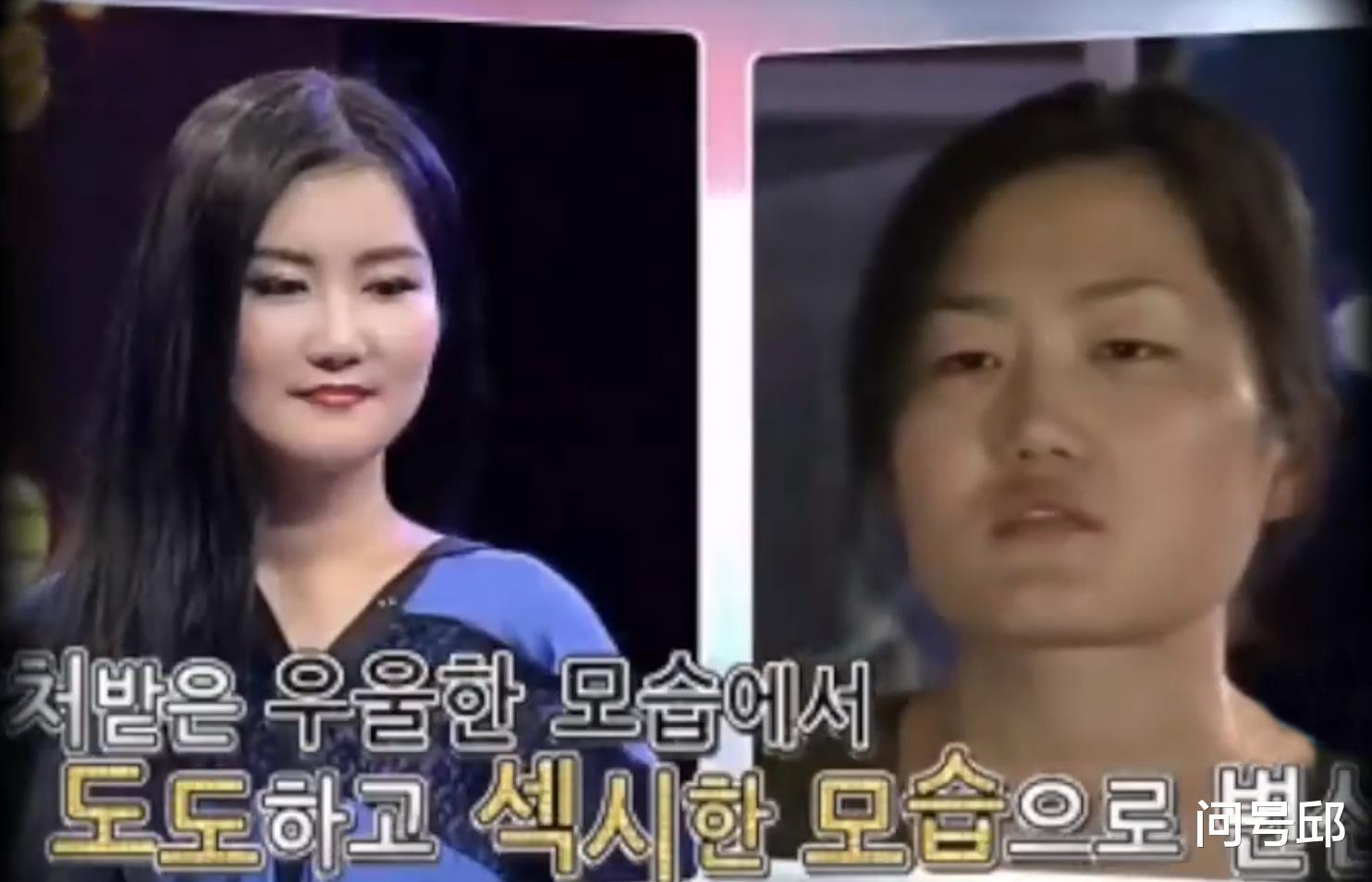 庄锶敏|刀锋下的“美丽”:带着美梦远赴韩国整容,最终毁容成了噩梦