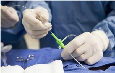 癌细胞|科学新知:癌症自愈或有4个“可能”,可惜很多人都没把握住!