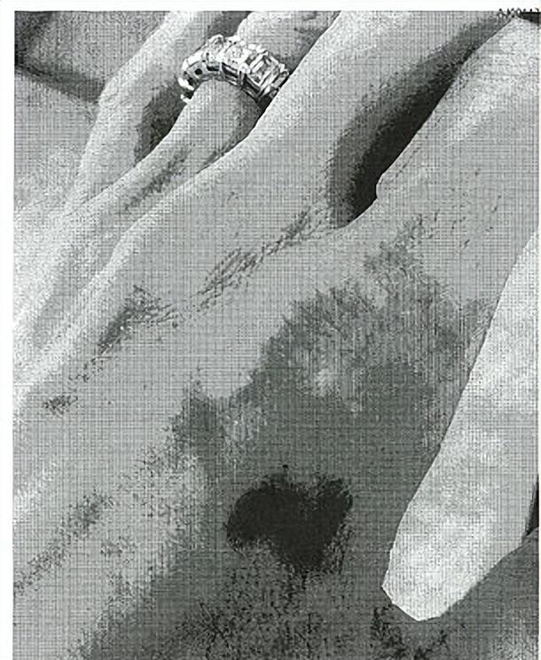 安吉丽娜·朱莉|朱莉向法庭提交遭家暴照片，申请向公众曝光，手和肘部有明显瘀伤