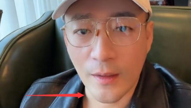 汪小菲|汪小菲新冠痊愈复工，嗓子沙哑脖子上肿包明显，身体状况令人担忧