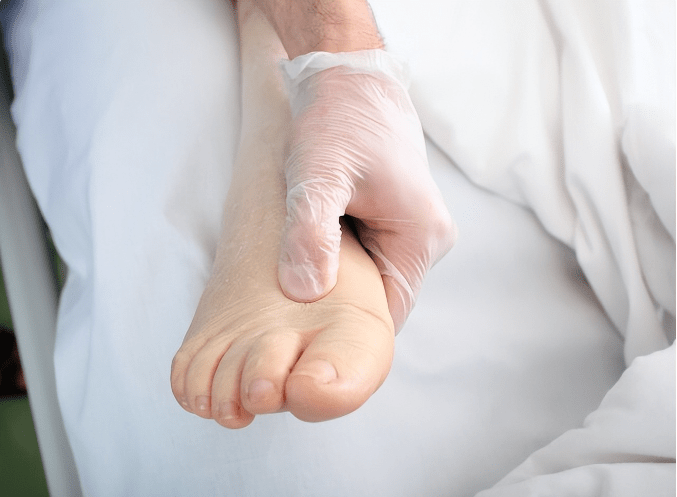 长寿|尿蛋白危害不只肾衰竭!肾科医生指出:降蛋白关键还在2点