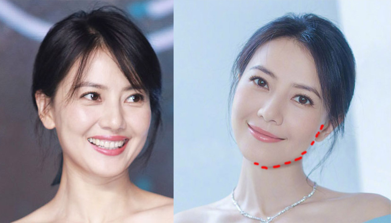 高圆圆 高圆圆发型真是太炸了！美的不像40+ 圆方脸6个技巧！减龄又瘦脸 。