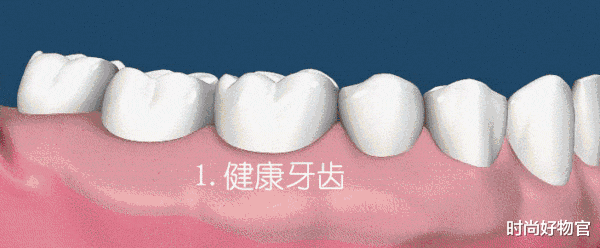 时尚好物官 比普通牙刷还便宜的电动牙刷,2分钟清理整个口腔,黄牙都不见了