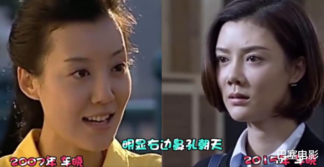 牛莉|好好的美女非去弄鼻子,林心如鼻子像被夹住,牛莉一个鼻孔两个大