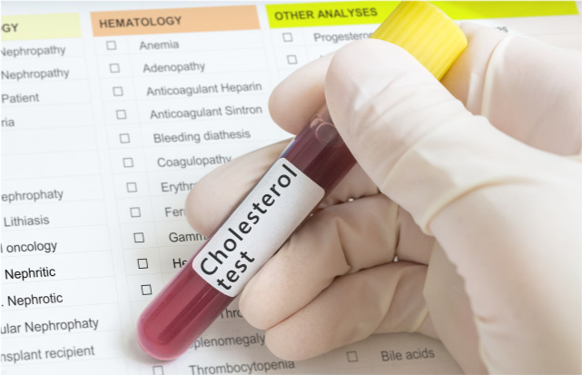 中医养生|不想给血管“添堵”,要尽早清除三种血管“垃圾”,望你早做了解