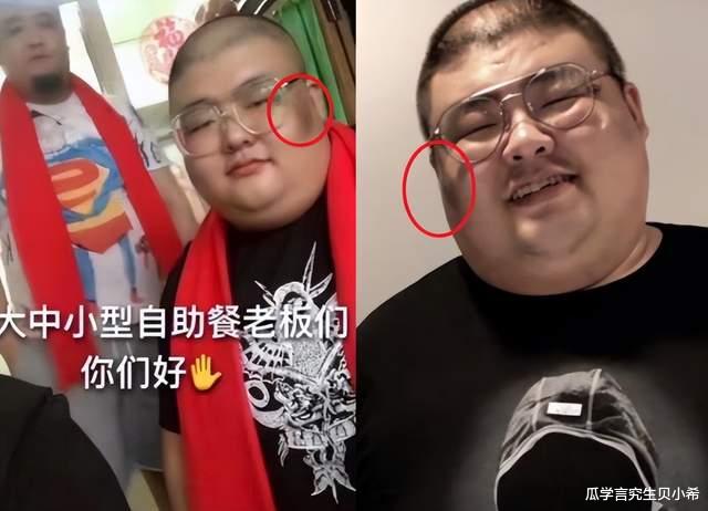 遇害、暴食、触电、整容暴毙,年轻网红在逐利的路上,死得花样百出
