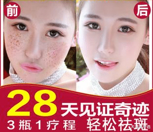 面霜 脸上长“色斑”不必慌,这款平价“精华液”,美白淡斑还嫩肤