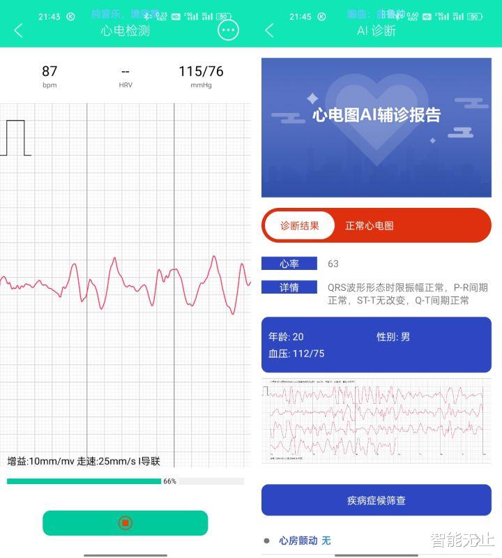 云盘|主打血压心电图检测，dido E10智能手表守护健康，带来便捷生活体验