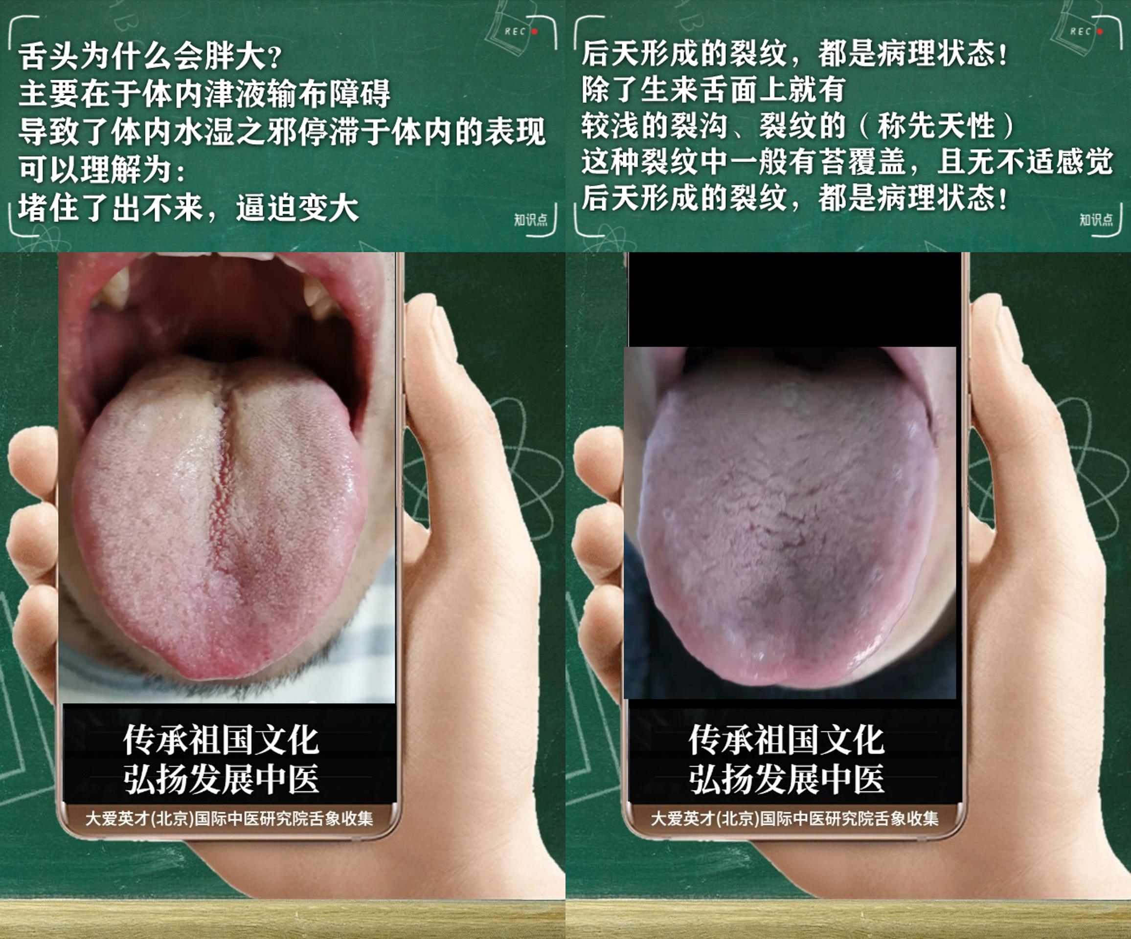 |中医实解:慢性胃炎,胃胀气,鼻子不通,胆胃上逆