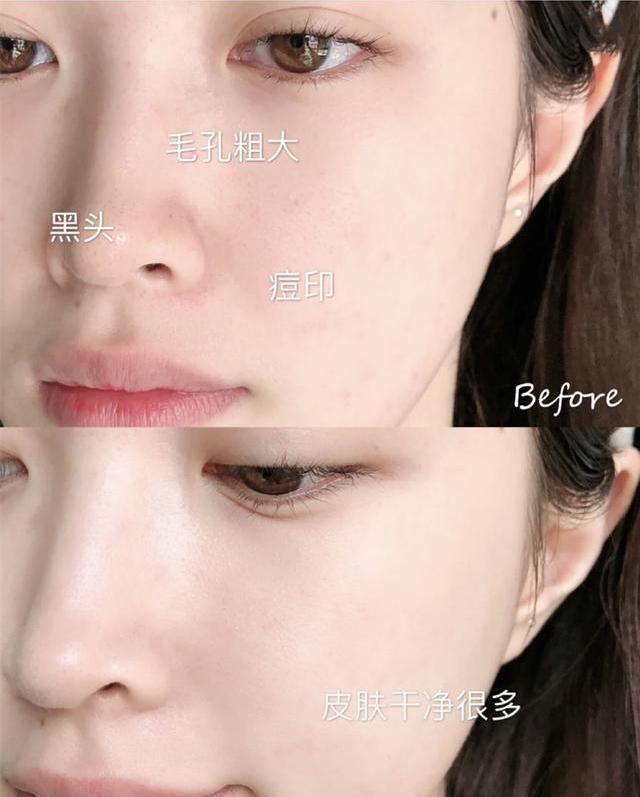 刘涛|刘涛皮肤好到女星都羡慕，分享的“洗脸法”走红，李小冉：用很多年了