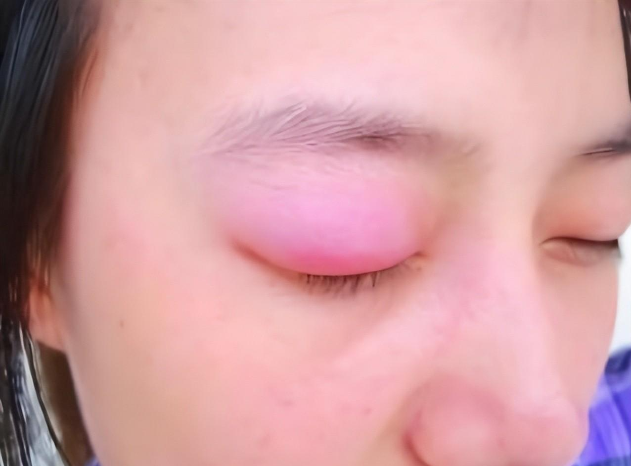 尿毒症|为什么“尿毒症”越来越多?医生劝说:3个习惯别碰,肾会感谢你