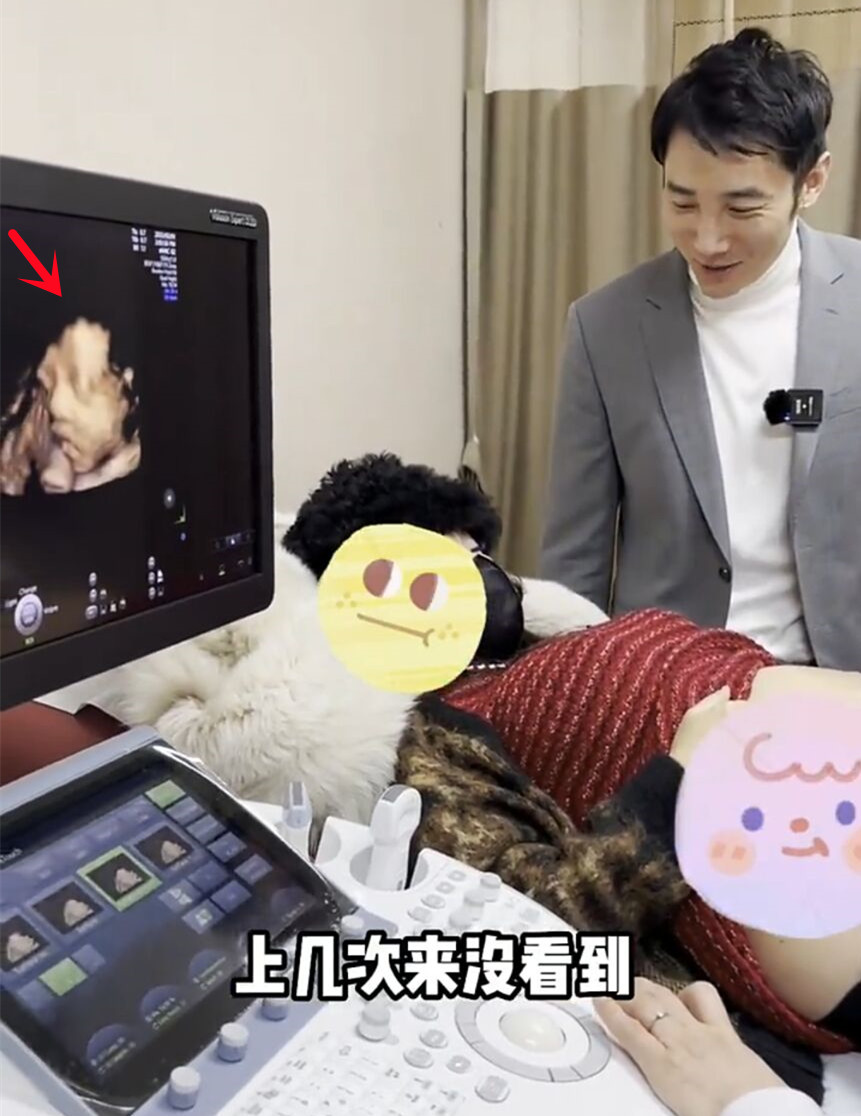 丁一|白冰前夫已再婚,带娇妻产检超恩爱,宝宝四维图曝光鼻子像爸爸