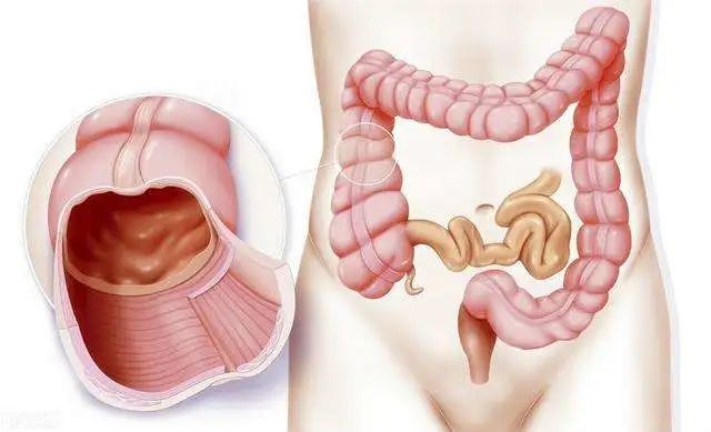 穴位|长期“大便不成形”?或是这4个原因在“捣鬼”,早知道早预防!