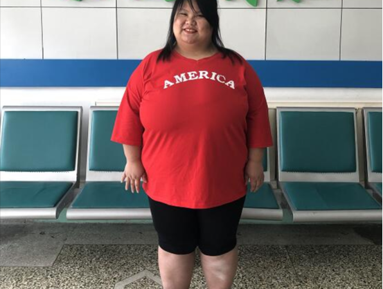 王祖蓝|当年的“校花”陈皖枝,婚后被丈夫喂至300多斤,床都被睡塌过2张