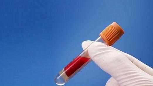 高血脂|中年男人得高血脂后,常吃三道菜可以帮到你,降低血脂保护血管