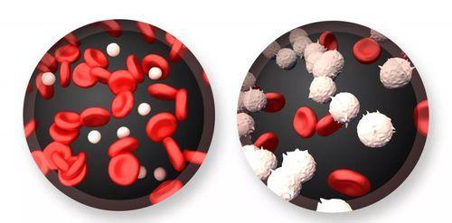 医生|一天一片阿司匹林,身体可以承受住吗?不隐瞒,医生说出实话