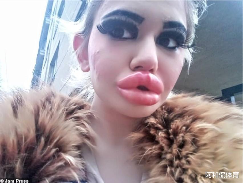 女孩 外国女孩狂打30次丰唇针是什么效果？再打鼻孔就快堵了