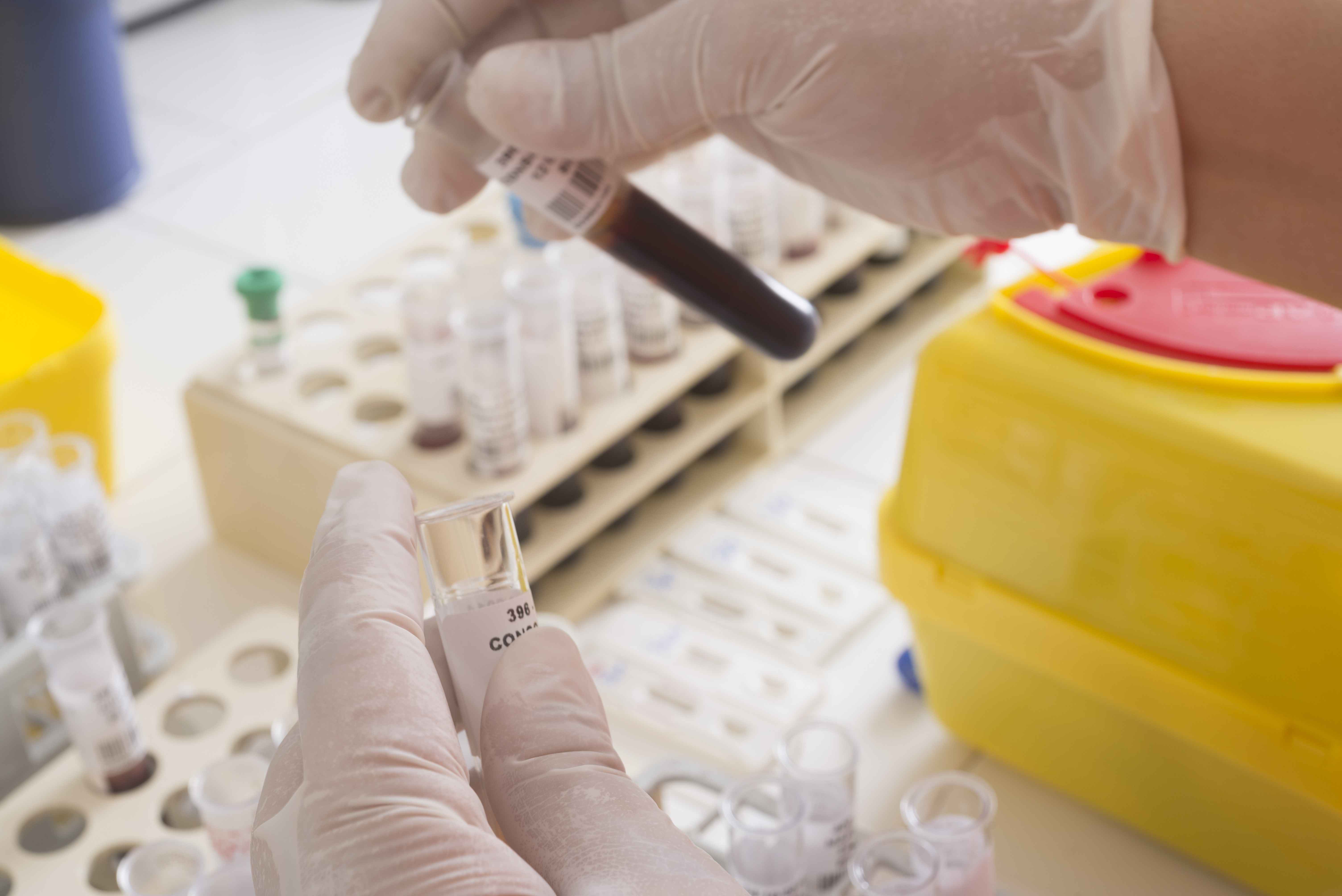 医院|体检查出甘油三酯超标?别慌!这2个时间段多喝水,或能稀释血液