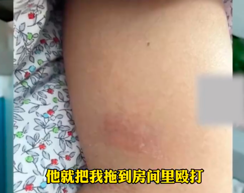 ?女子因在家里看街舞综艺被丈夫殴打?