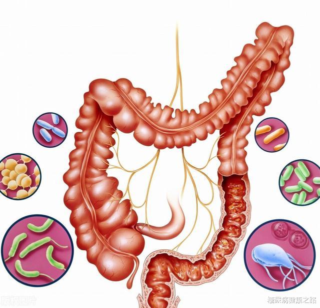 |慢性压力为什么促进糖尿病发生?肠道菌群作用很关键