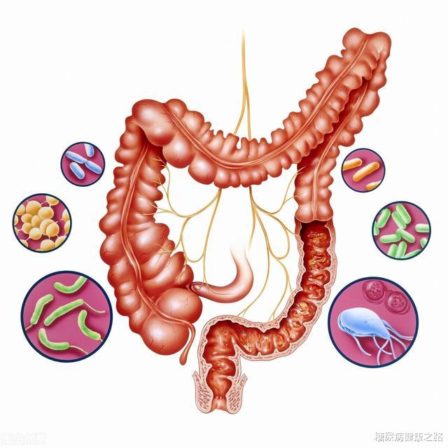 维生素D|糖尿病人怎么改善肠道菌群？《自然》杂志：可能需要补充维生素D