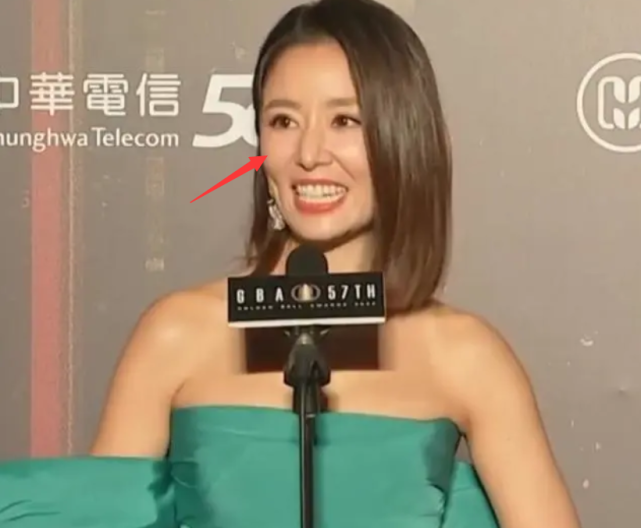 林心如|林心如鼻子怪异被质疑整容，本人发声否认：从出生以来就长这样