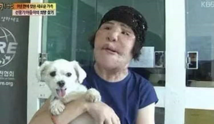 韩慧景|女星韩慧景：为了更漂亮，给脸注射食用油，把脸整成“猪头”