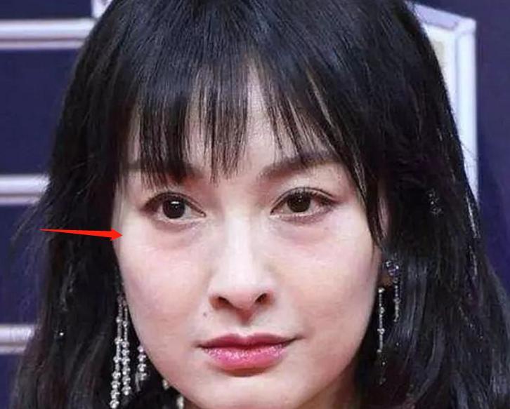 张蔷|做过眼袋手术的明星：张蔷直言后悔，闫学晶自曝割眼袋和双眼皮