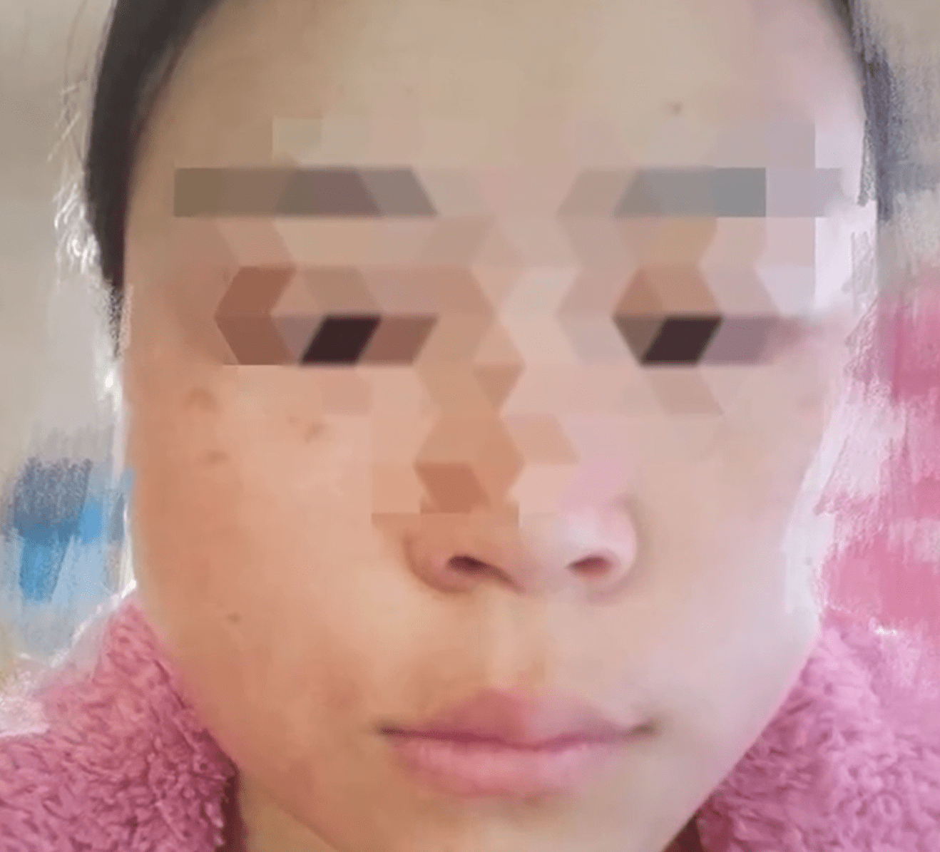 ?23岁女子被公公用板凳砸头，当事人：被他打过多次，睡都睡不安稳，已决定离婚！