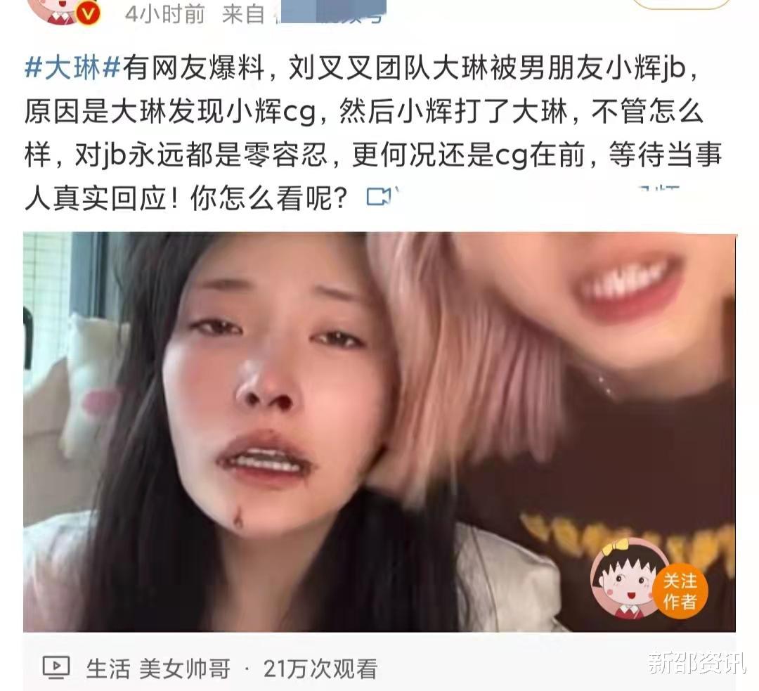 气愤!美女网红被男友暴打,满脸血边直播边报警,男友被扒是惯犯