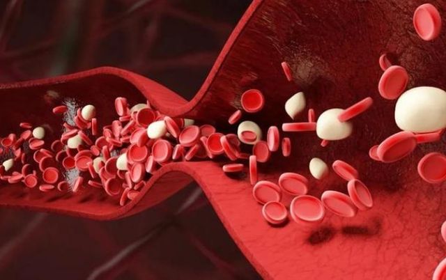 姐姐|血脂高，夏季不能吃“葡萄”吗？医生：降血脂，5种蔬菜或可常吃