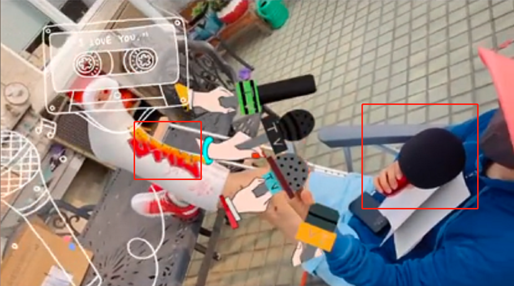 孙悦|50岁孙悦躺豪宅院内休养！抬高伤脚卖力唱歌，院内杂物堆一地