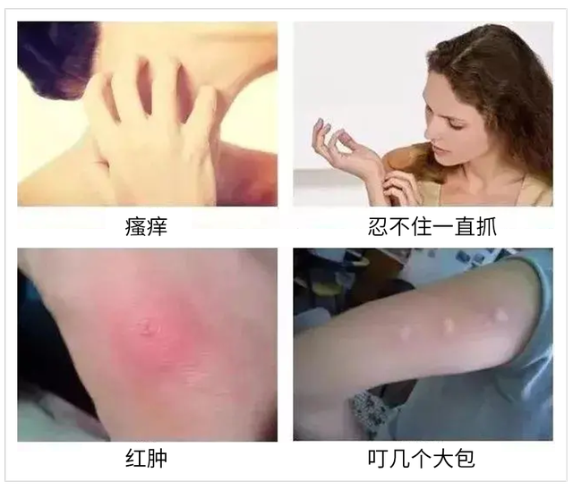 多数人不知蚊子怕啥?教你一个小窍门,开窗都不怕,整夜安睡