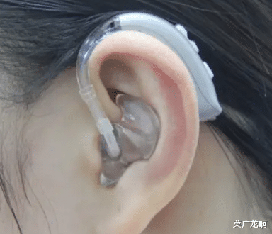 案例回顾:湖南22岁聋哑女子和新婚丈夫争执时,因气不过突然开口说话