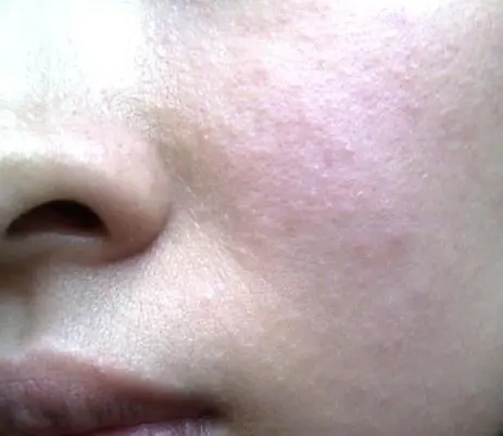 穿衣搭配 常年化妆会对皮肤造成什么影响,这一点还是要清楚的