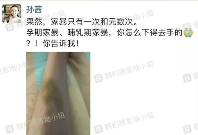 孙茜|演员孙茜疑遭老公家暴,孕哺乳期对其动手,晒受伤照片引热议