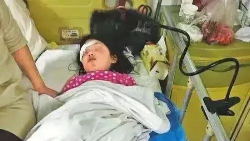 无人机坠落砸伤三岁女童小雪头部。法院判决小雪自己承担30%？