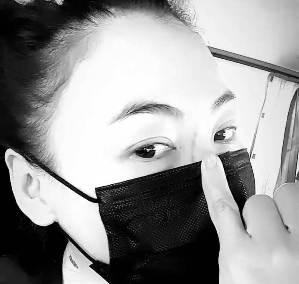 张柏芝|张柏芝遭家暴？脸部现超长伤口，她直呼很痛