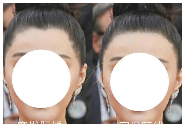 发际线|朴敏英新剧《月水金火木土》,这个发际线好像戴了个假头套?