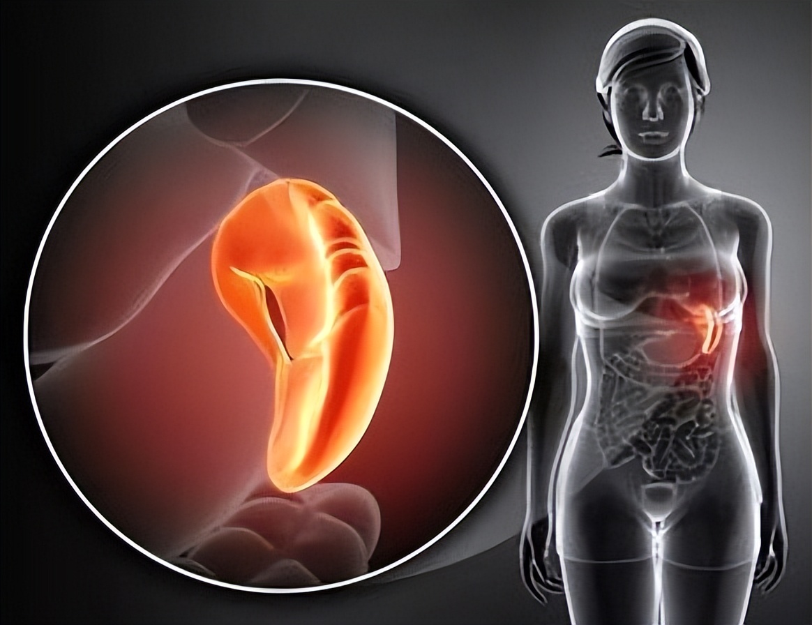 健脾|万病归于脾,脾健病无踪,送你4个中成药,健脾养脾,祛湿和胃