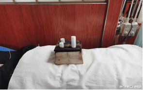 卵巢早衰|月经过少的烦恼，中医来调一调