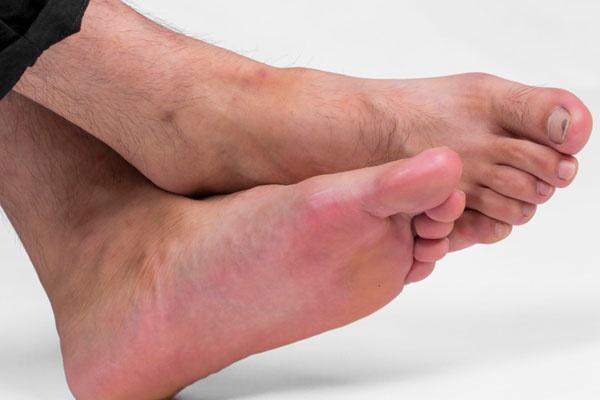 更年期|血管堵没堵?看看脚就知道,腿脚出现1种变化,或需疏通血管